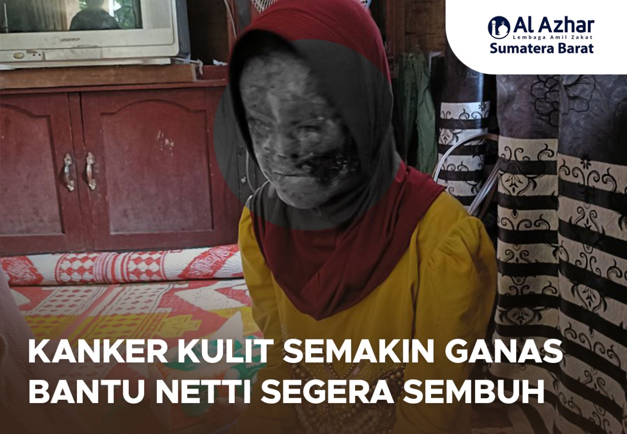 Pulihkan Harapan Mereka, Bantu Pejuang Kanker Kulit Bangkit Kembali